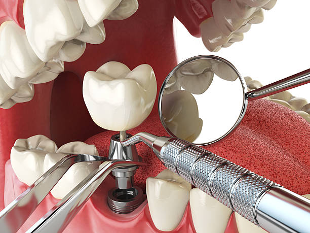 Best Urgent Dental Care in New Carrollton, MD